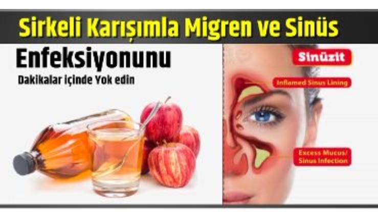 elma sirkeli karisimla migren sinus enfeksiyonunu dakikalar icinde yok edin