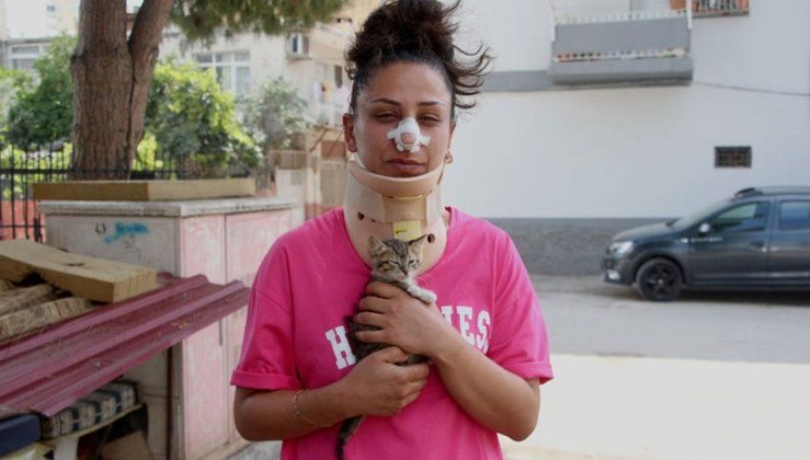 Kedilerini Pitbull Saldırısından Kurtarmak İsterken Yaralandı