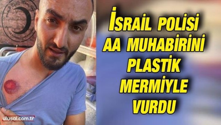 İsrail polisi Anadolu Ajansı muhabirini göğsünden plastik mermiyle vurdu