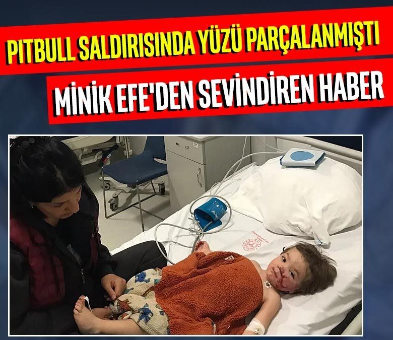 Pitbull saldırısında yüzü parçalanmıştı! Minik Efe'den günler sonra haber geldi