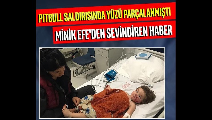 Pitbull saldırısında yüzü parçalanmıştı! Minik Efe'den günler sonra haber geldi