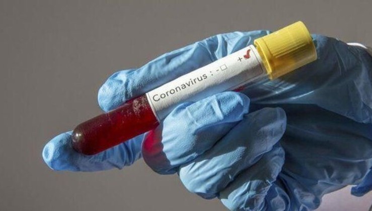 Coronavirüse karşı İsviçre'den umutlandıran açıklama! "1 Nisan itibariyle...".