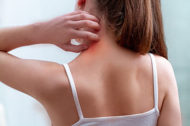 Tratamientos para la psoriasis