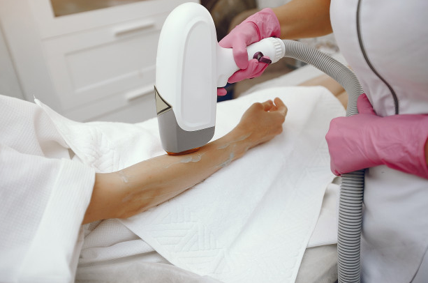 إزالة الشعر: الشمع مقابل الليزر