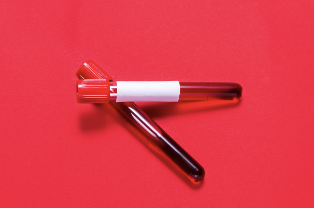 Kansızlık Nedir, Belirtileri Nelerdir?