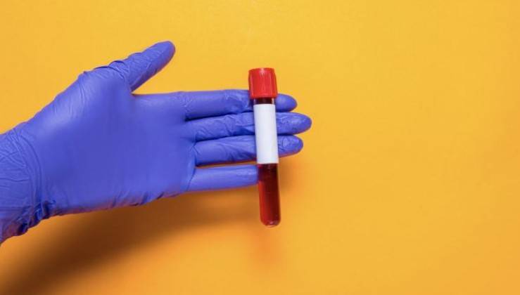 Kansızlık Nedir, Belirtileri Nelerdir?