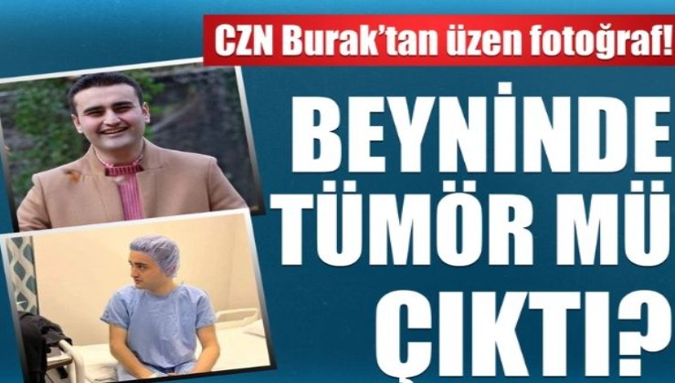 CZN Burak'tan üzen fotoğraf: Beyninde tümör mü çıktı?