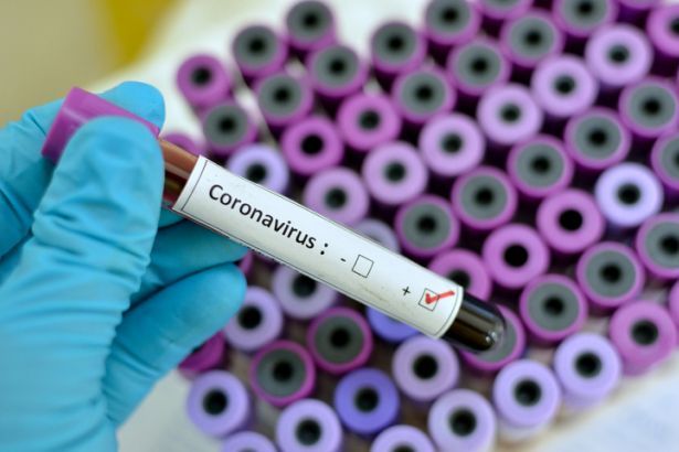 Küba ilacı yeni koronavirüs tedavisinde etkili oldu