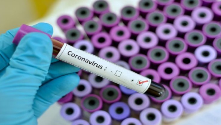 Küba ilacı yeni koronavirüs tedavisinde etkili oldu