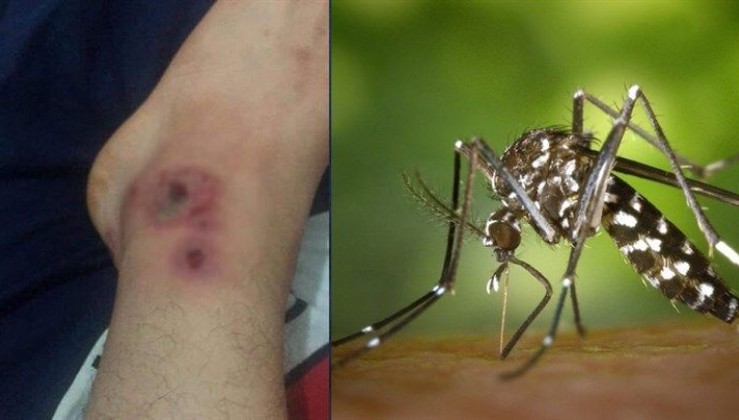 İstanbul'da "Asya Kaplanı" Sivrisineği Alarmı! Isırığındaki Virüsler Kana Karışırsa...