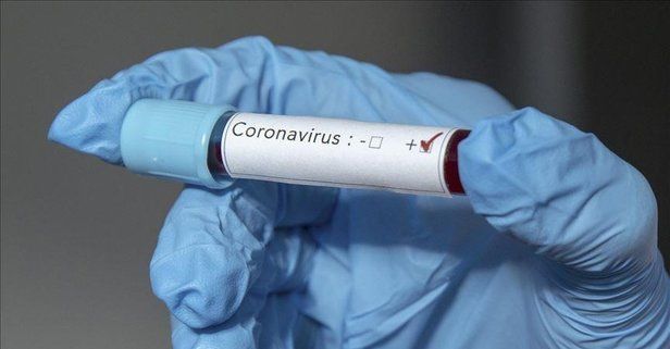 Dünya genelinde koronavirüs (Kovid19) nedeniyle ölenlerin sayısı 20 bini aştı.