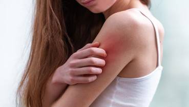 Tratamientos para la psoriasis