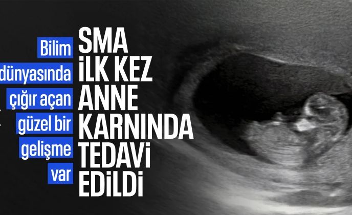 SMA'da dikkat çeken gelişme: İlk kez anne karnında tedavi edildi