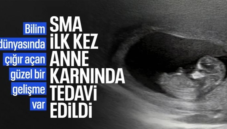 SMA'da dikkat çeken gelişme: İlk kez anne karnında tedavi edildi