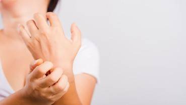 علاج الصدفية