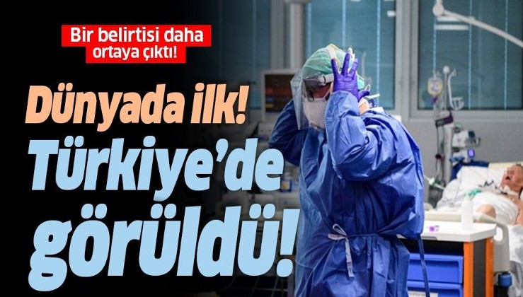 Koronavirüsün bir belirtisi daha ortaya çıktı! Dünyada ilk kez Türkiye’de görüldü!