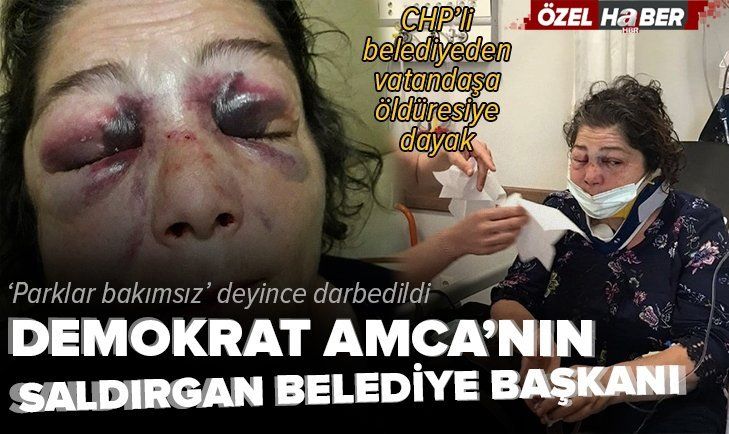 CHP'li Eynesil Belediye Başkanı Ahmet Latif Karadeniz'in adamları 'parklar bakımsız' diyen kadını hastanelik etti!