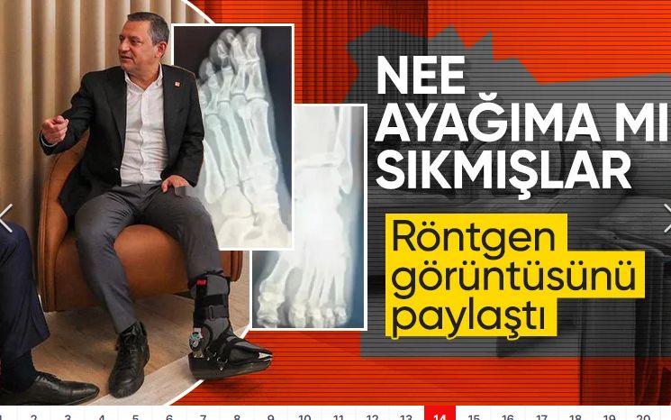 Özgür Özel ayak röntgen filmlerini paylaştı