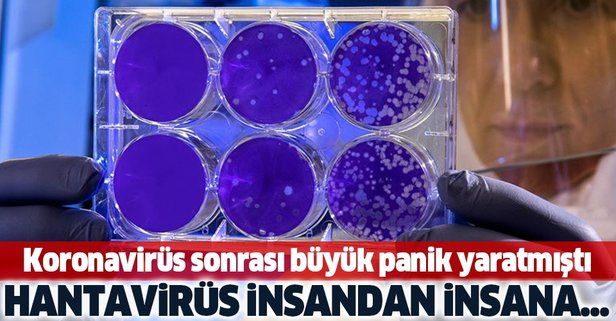 Koronavirüs salgını sonrası panik yaratmıştı! Hantavirüs insandan insana....