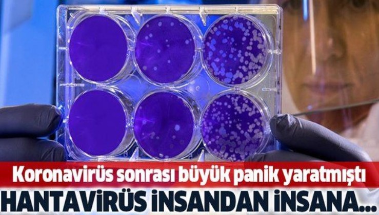Koronavirüs salgını sonrası panik yaratmıştı! Hantavirüs insandan insana....
