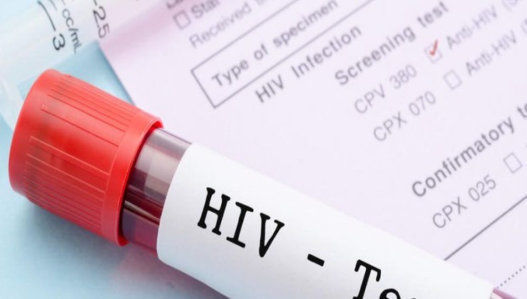 Başarılı Klinik Denemeler, HIV Tedavisinde Yeni Bir Dönemi Başlatabilir