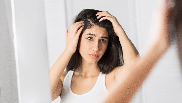علاج الصدفية