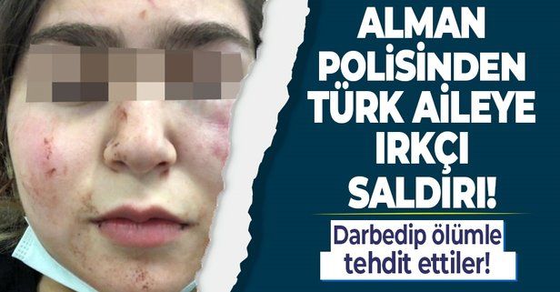 Alman polisinden Türk aileye alçak saldırı! Darbedip ölümle tehdit ettiler