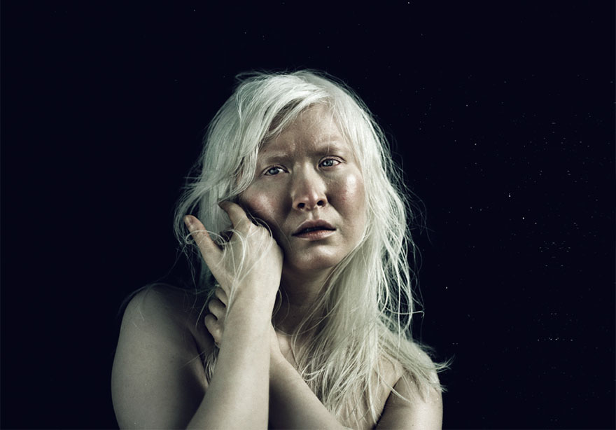 Albino People Wholl Mesmerize You With Their Otherworldly Beauty