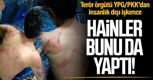 Terör örgütü YPG/PKK'dan insanlık dışı işkence! Böbreğinin biri çalışamaz hale geldi