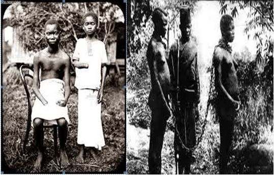 Belçika’nın Kara Tarihi: Kral II. Leopold’un Kongo Katliamı